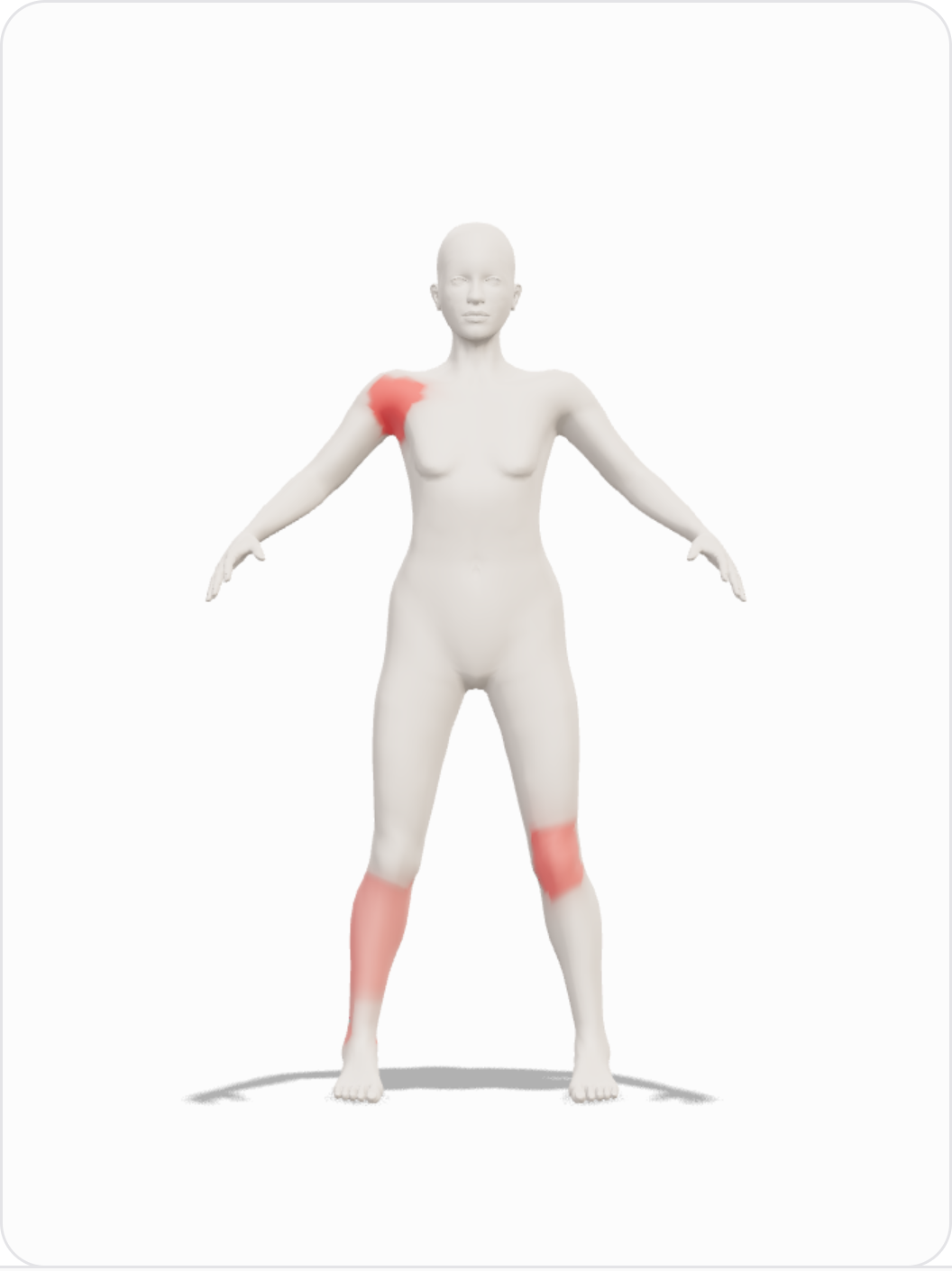 A figura do corpo na tela de avaliação, com marcas de dor registradas.